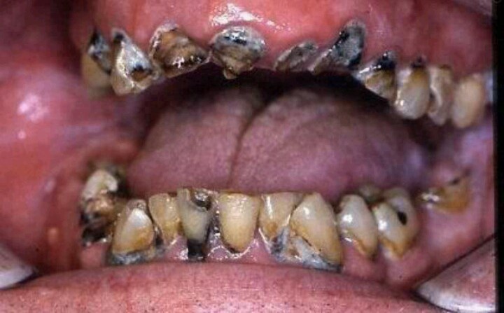 67321f22209f63ac79a0fa27cc46cfde--meth-mouth-a-holiday.jpg
